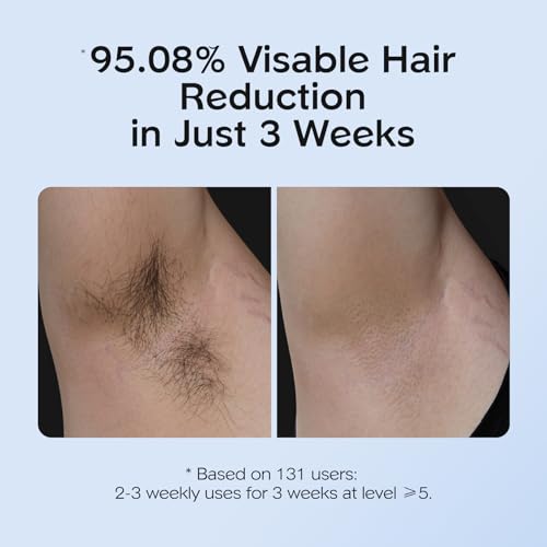 Cooling IPL Hair Removal Device