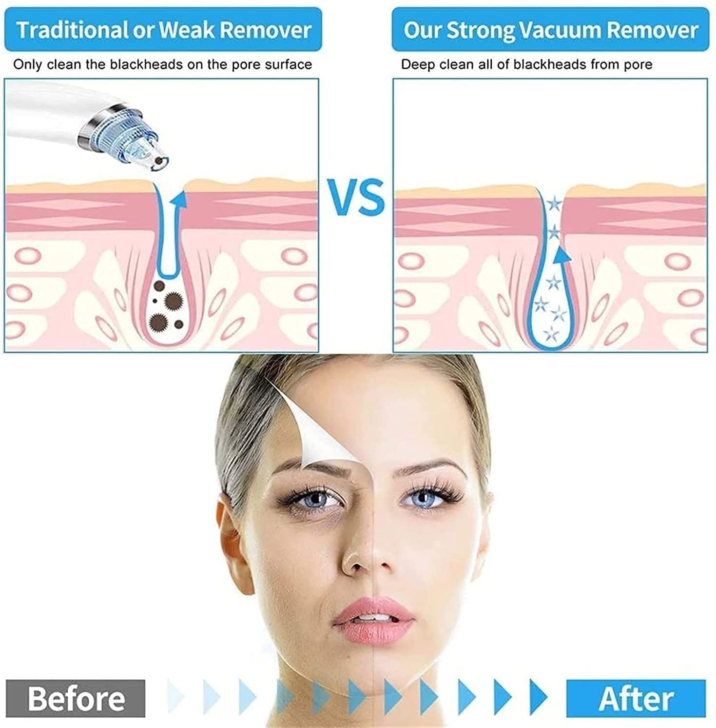 Adjustable Pore Vacuum