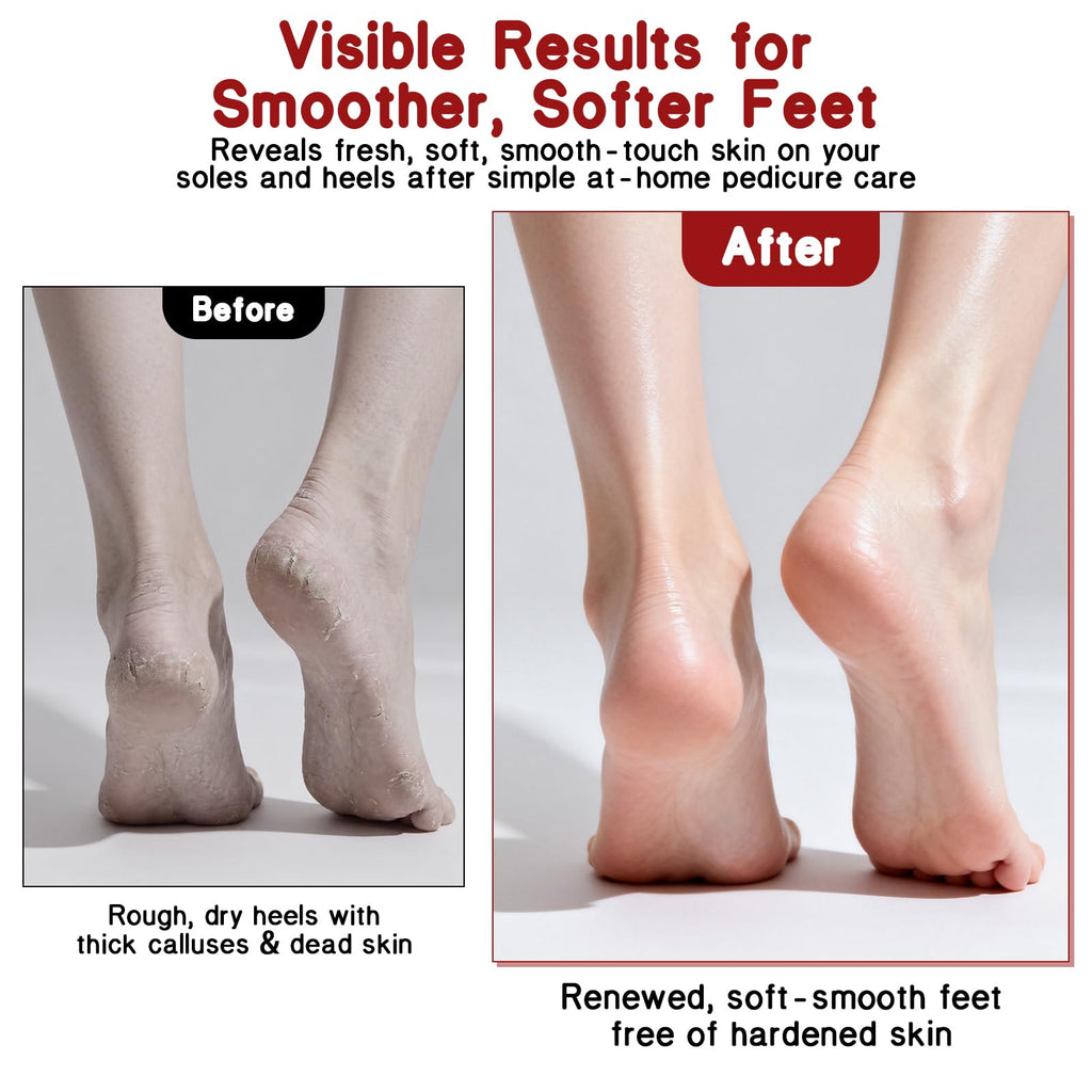 Dual-Sided Stainless Steel Foot File