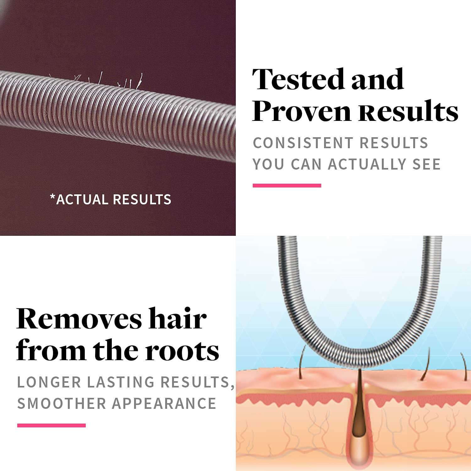 Facial Hair Removal Spring