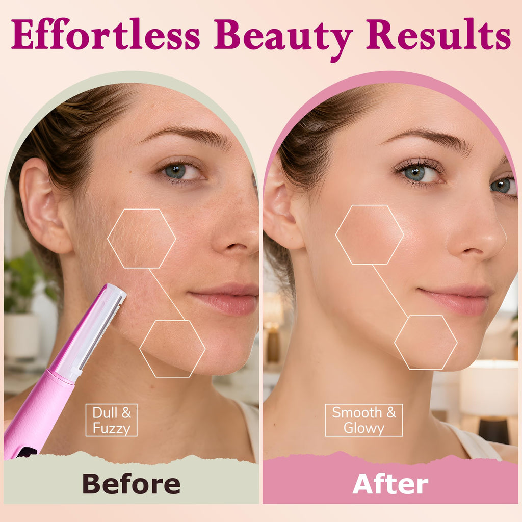 Sonic Dermaplane Razor Kit