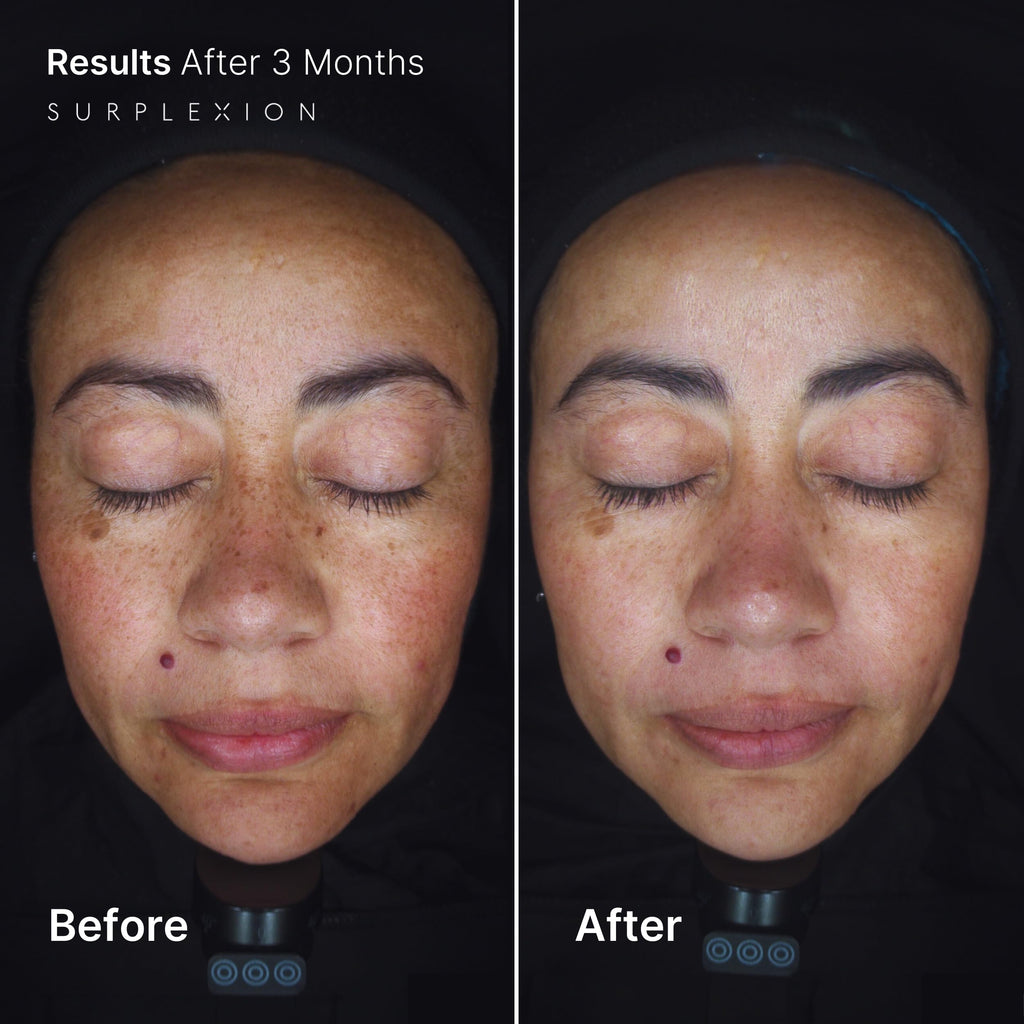 Acid-Blend Brightening Face Cream