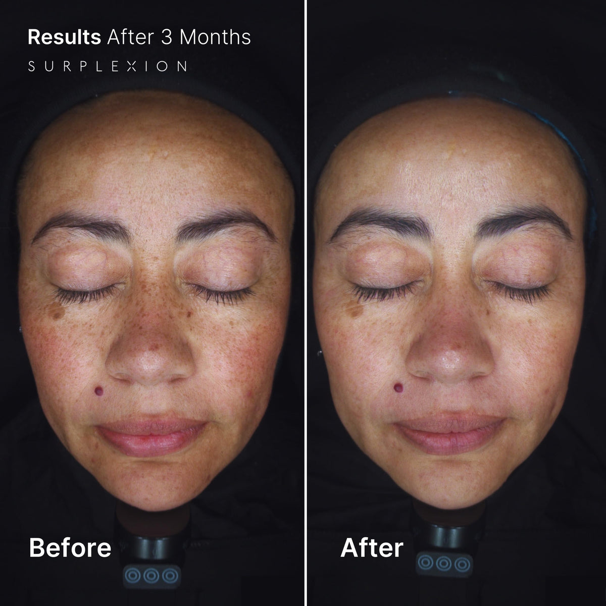 Acid-Blend Brightening Face Cream